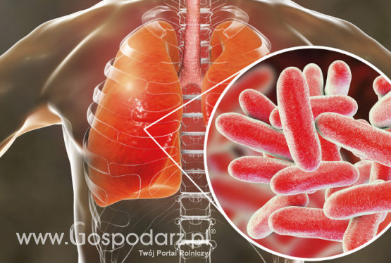 Legionella pneumophila pod okiem naukowców z SGGW
